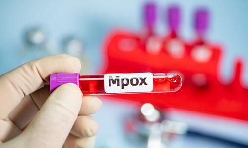 Σύλληψη δύο επιστημόνων για λαθραία εισαγωγή ιού mpox στις ΗΠΑ