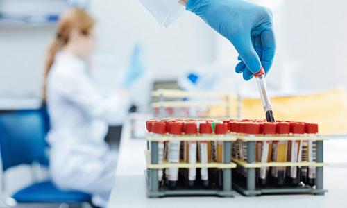 Νέα εξέταση αίματος υπόσχεται καλύτερη σταδιοποίηση της νόσου Αλτσχάιμερ