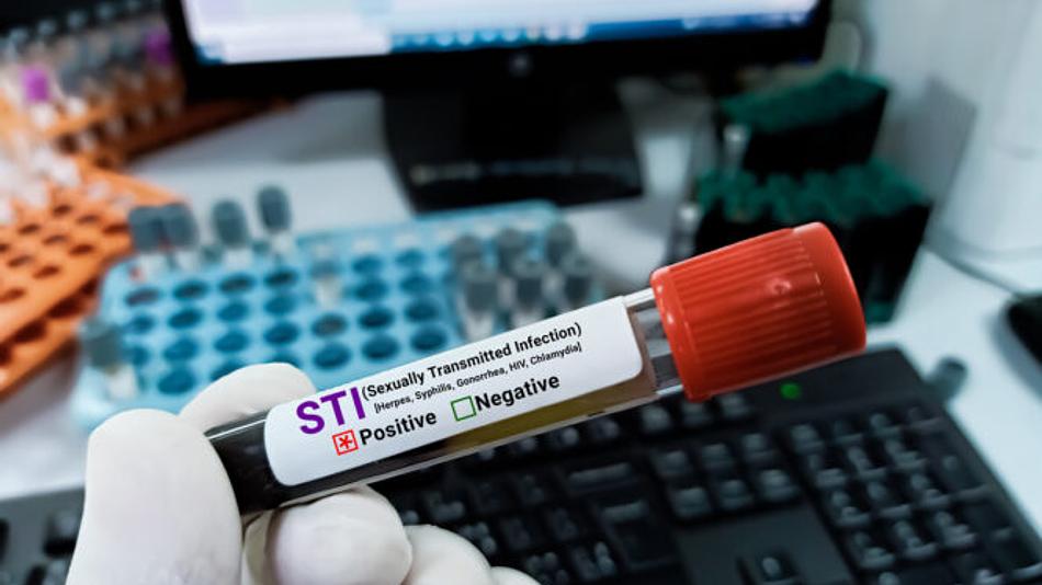 Δημιουργία παγκόσμιας βάσης δεδομένων για τα σεξουαλικώς μεταδιδόμενα νοσήματα από τον ΠΟΥ